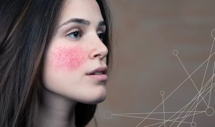 Although there is currently no cure, there is great promise in the fight against lupus. Real-world data and artificial intelligence are both critical to the future of clinical research.